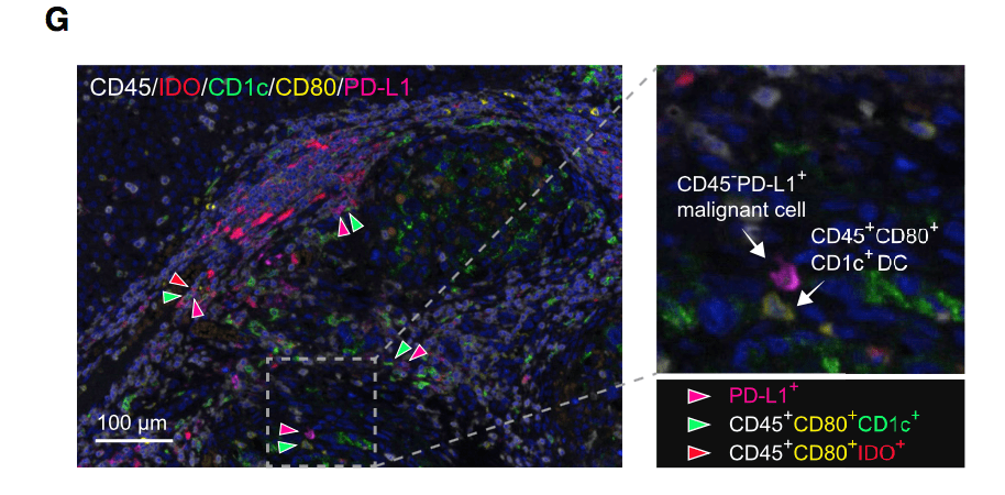 最新虹膜征象，探索医学领域的崭新突破